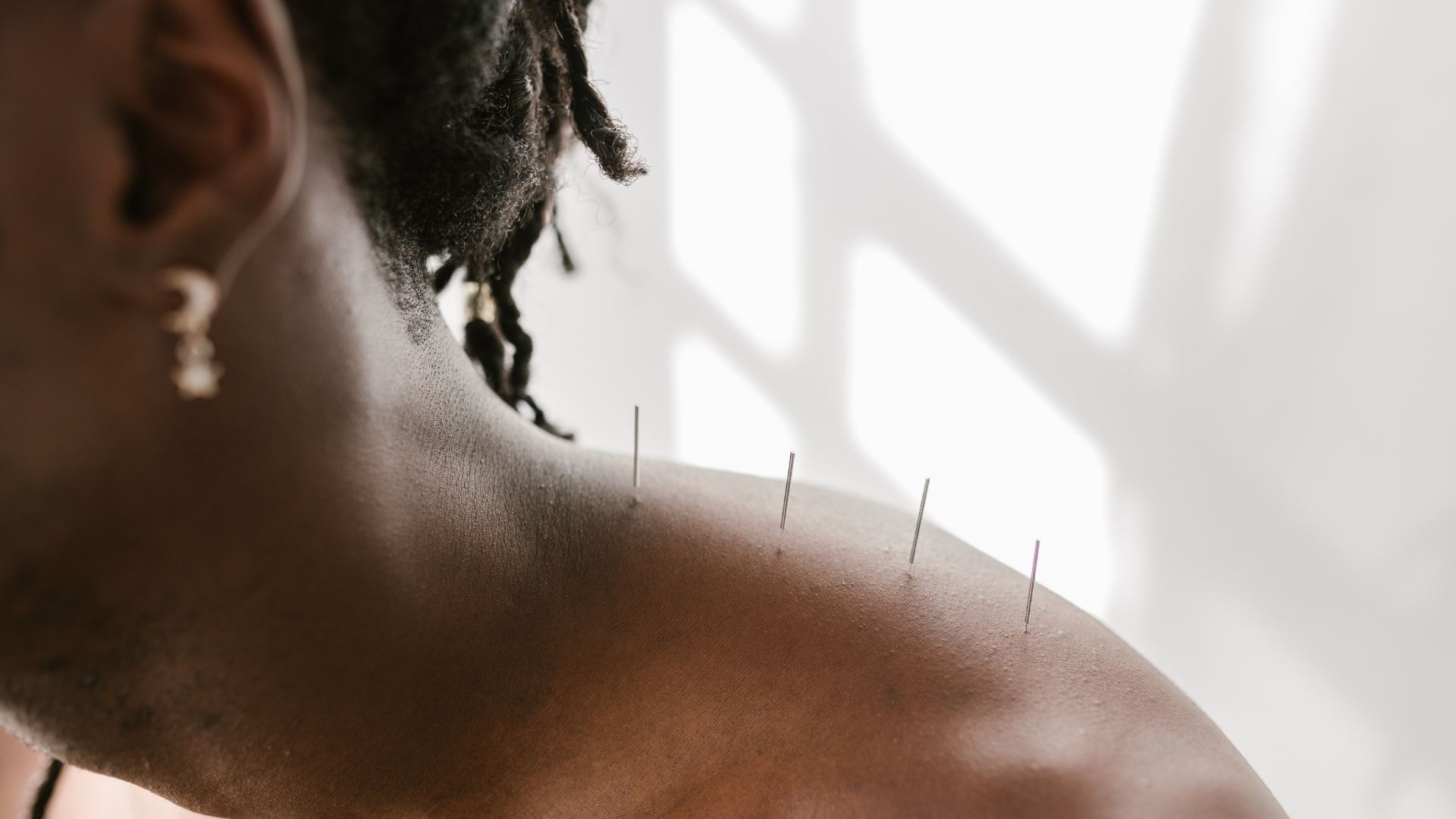 DEPRESSION TREATMENT WITH ACUPUNCTURE in Istanbul